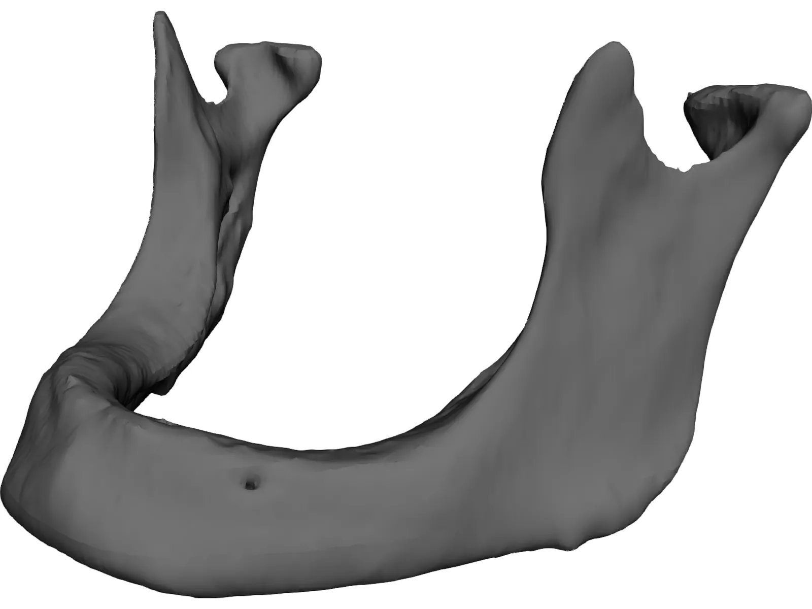 Edentulous Jaw 3D Model main preview