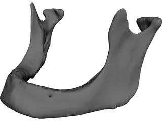 Edentulous Jaw 3D Model preview