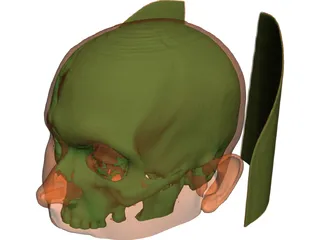 Human Skull InVesalius 3D Model preview