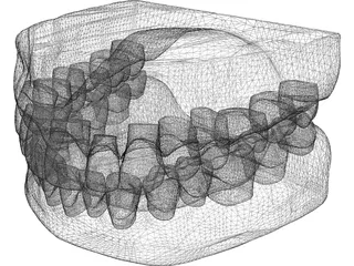 Teeth and Gums 3D Model preview