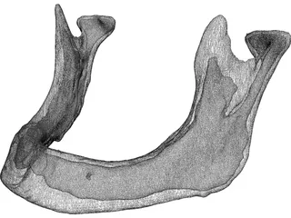 Edentulous Jaw 3D Model preview