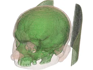 Human Skull InVesalius 3D Model preview