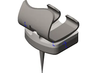 Knee Implant 3D Model preview