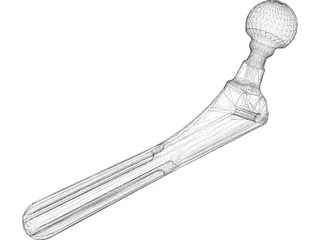 Hip Prosthesis 3D Model preview