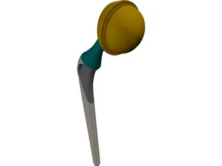 Artificial Hip 3D Model preview