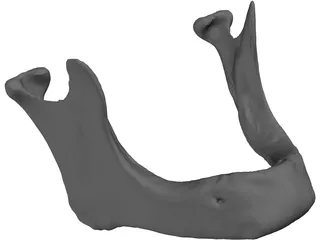 Edentulous Jaw 3D Model preview