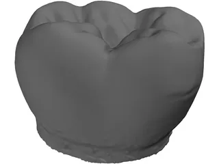 Molar Tooth 3D Model preview