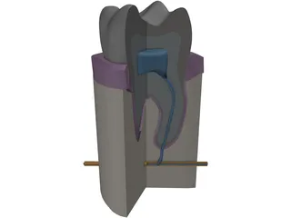 Molar Cutaway 3D Model preview