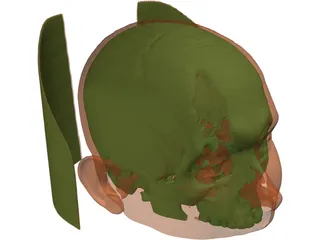 Human Skull InVesalius 3D Model preview