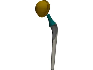 Artificial Hip 3D Model preview