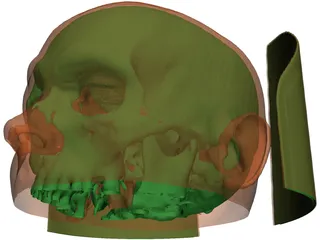 Human Skull InVesalius 3D Model preview