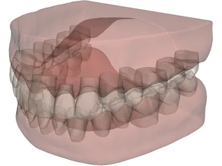 Teeth and Gums 3D Model preview