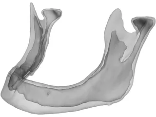 Edentulous Jaw 3D Model preview