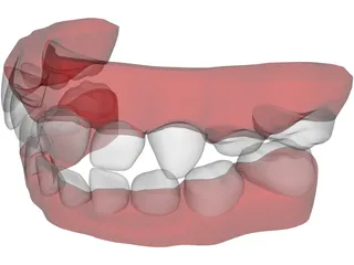 Teeth Childs 3D Model preview