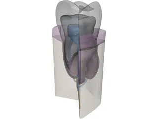 Molar Cutaway 3D Model preview