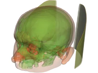 Human Skull InVesalius 3D Model preview