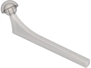 Hip Implant 3D Model preview