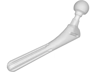 Hip Prosthesis 3D Model preview